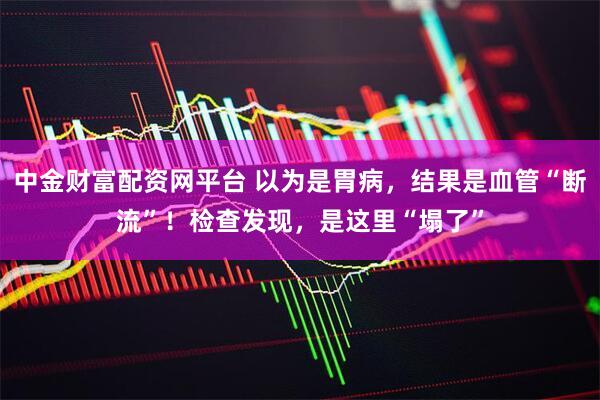 中金财富配资网平台 以为是胃病，结果是血管“断流”！检查发现，是这里“塌了”